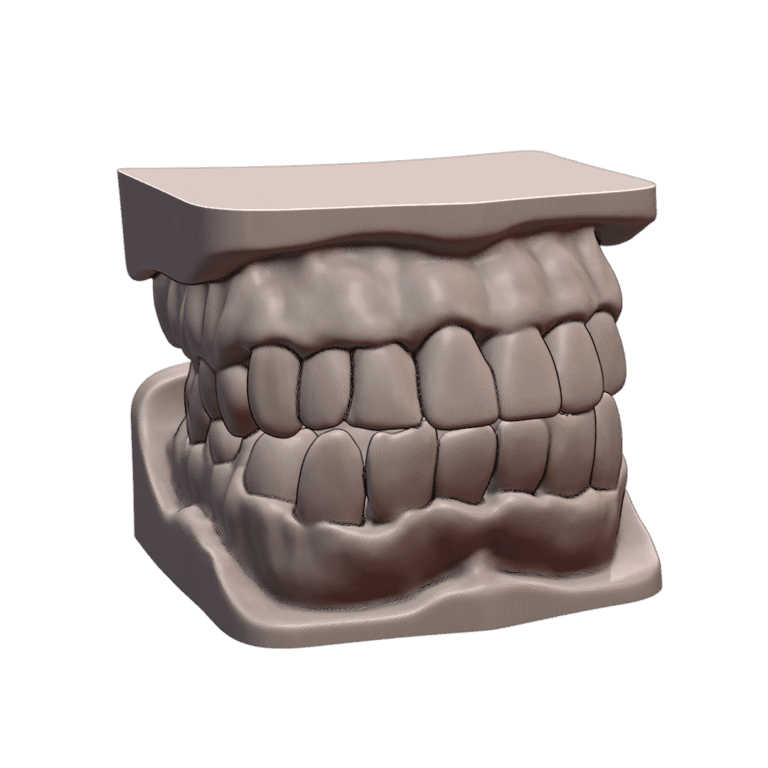 Education Model Human Teeth and Gums Anatomy for Dental Studies MineeForm FDM 3D Print STL File